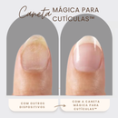 Caneta Mágica para Cutículas™ | Remova Cutículas Sem Dor, com Resultado Profissional em Casa
